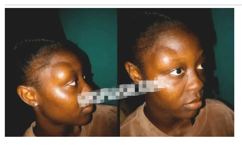 Mother Beats 20-Year-Old Daughter For Refusing To Marry A 40-Year-old Businessman Who Returned From the US