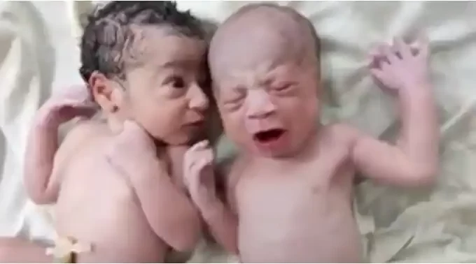Hilarious Moment Newborn Baby ‘Expressed Shock’ While Watching His Twin Brother Cry Loudly (Video)