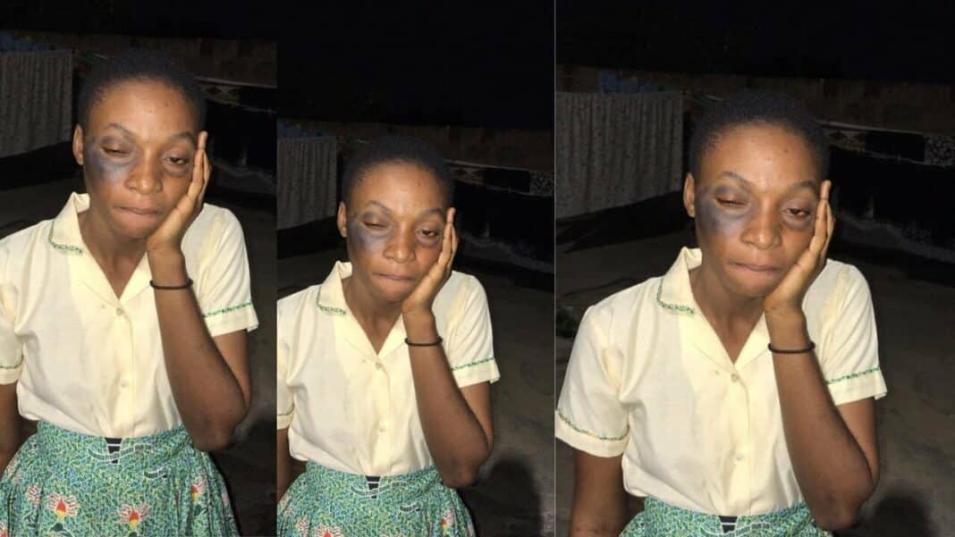 Nkwatia Presby SHS Student Goes Partially Blind After Hefty Slap By Academic Headmaster